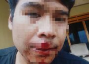 Dugaan Pengeroyokan Pendiri Media Daring di Ciomas Serang, Polisi Buru Tiga Terduga Pelaku