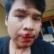 Dugaan Pengeroyokan Pendiri Media Daring di Ciomas Serang, Polisi Buru Tiga Terduga Pelaku