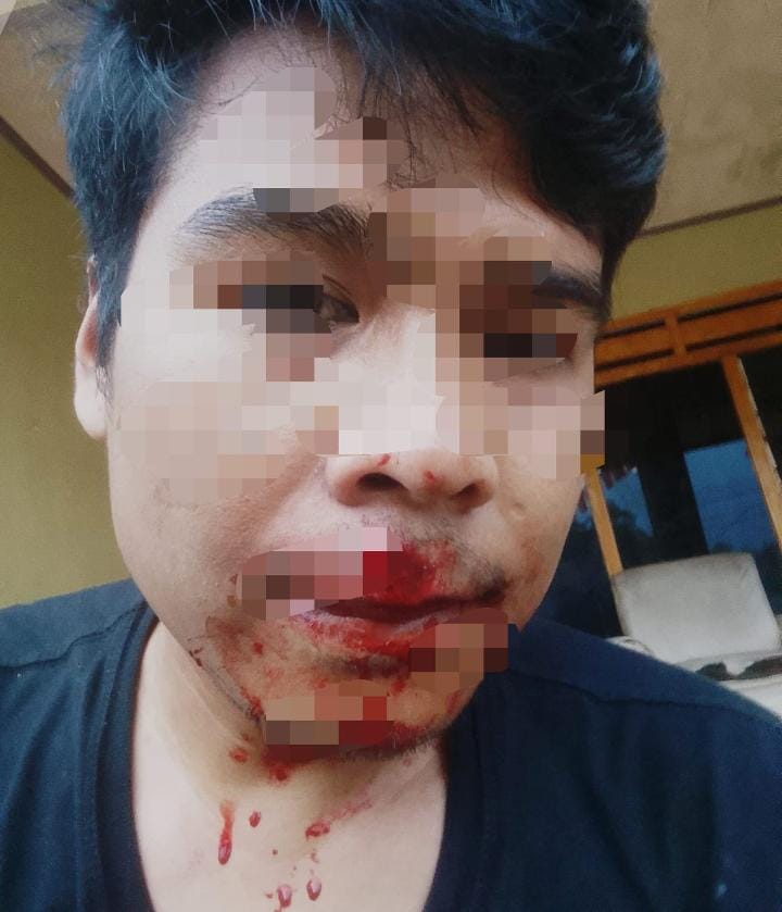 Dugaan Pengeroyokan Pendiri Media Daring di Ciomas Serang, Polisi Buru Tiga Terduga Pelaku